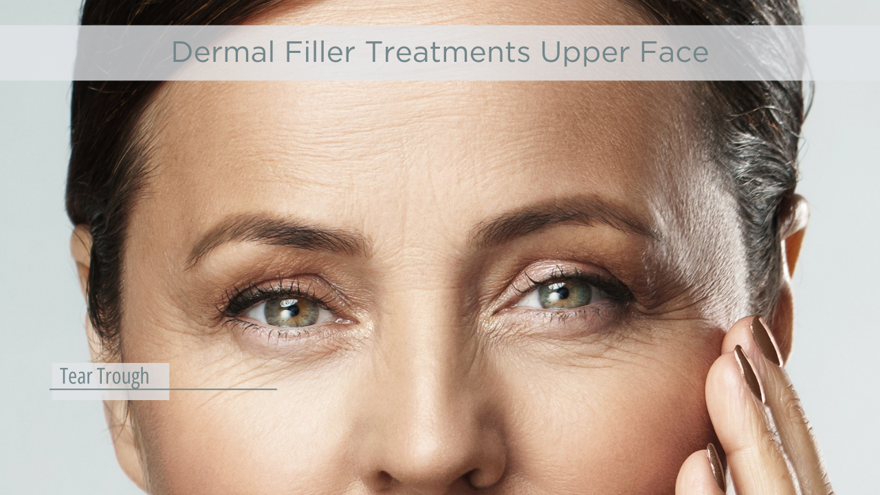 1. Dermal Fillers Upper Face
