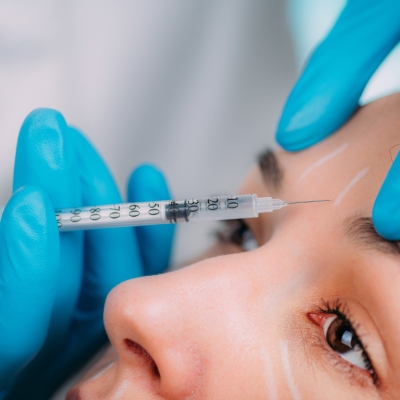 Injectable 3 Microneedling treatment